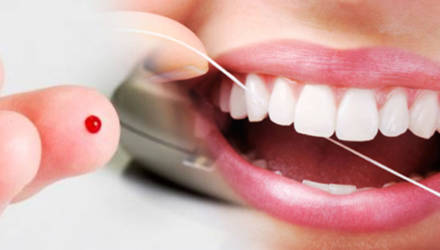 diabetes e o implante dentário