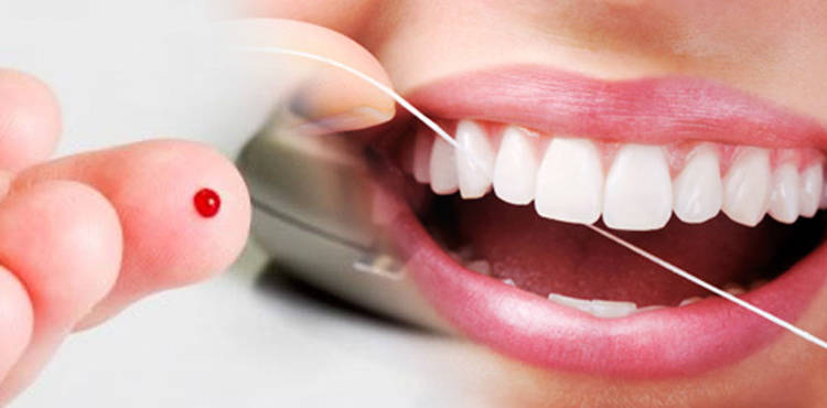 diabetes e o implante dentário