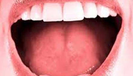doenças pela boca
