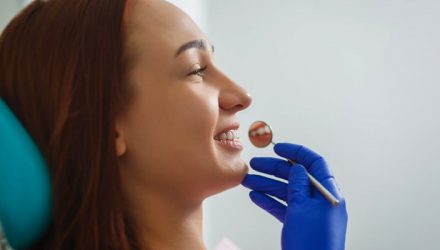 5 dicas clareamento dental